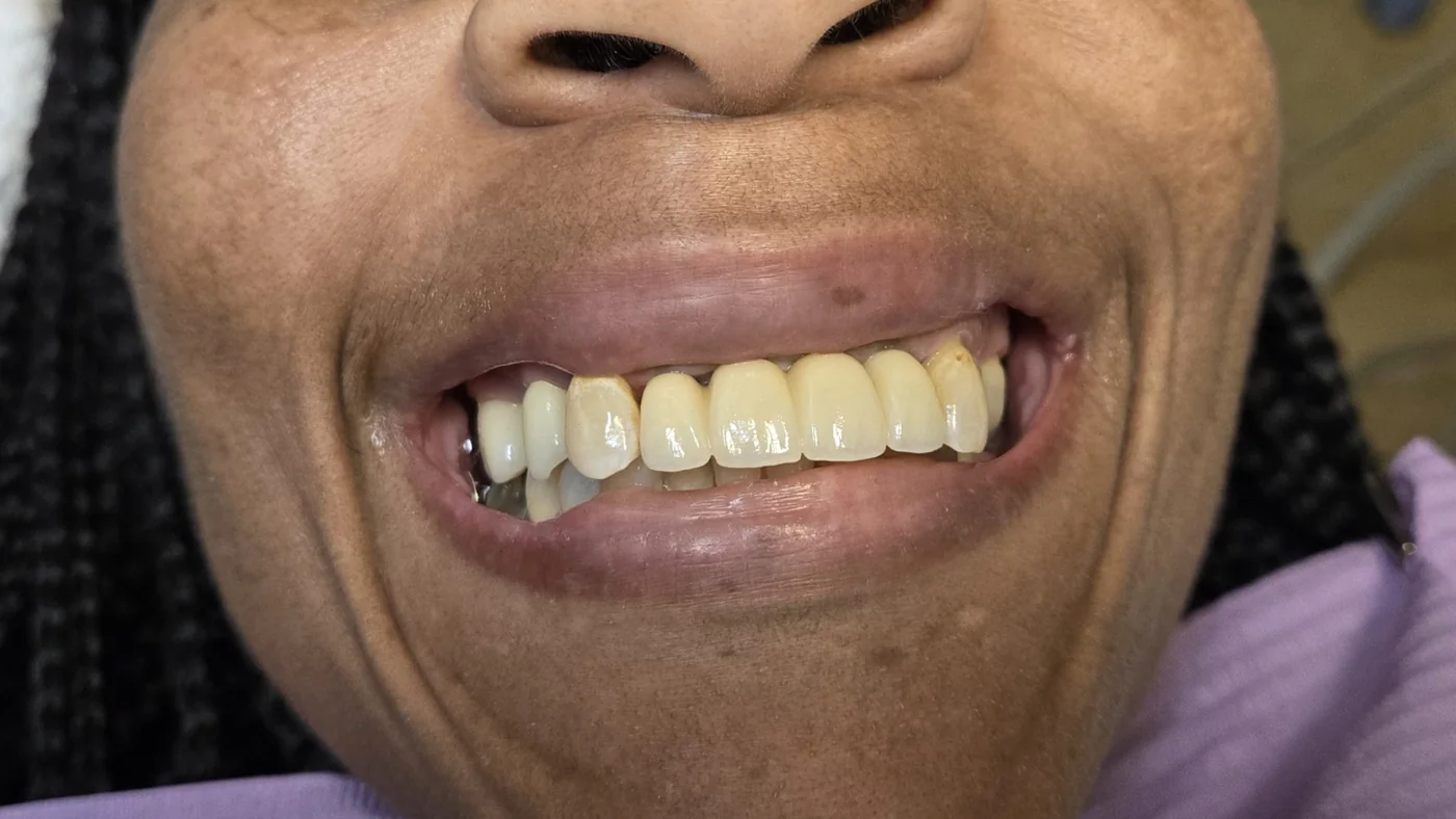 Chrystal after treatment photo