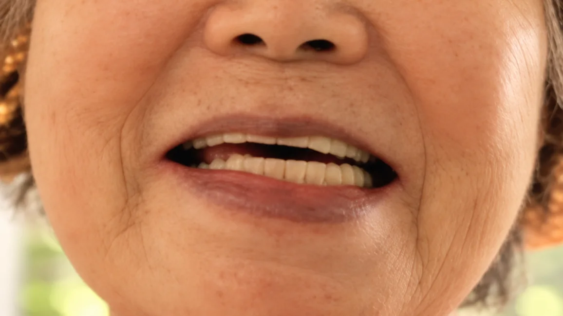 Case 01 — Real Patient Smile Transformation after treatment