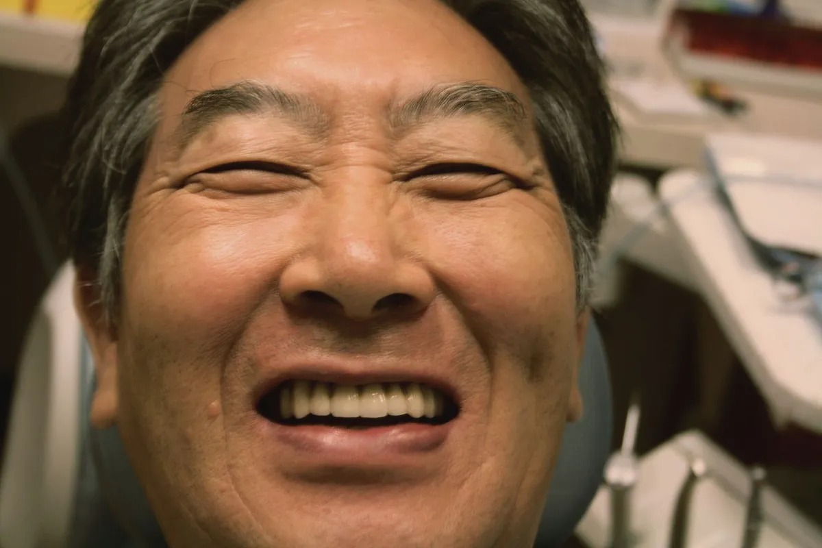 Case 03 — Real Patient Smile Transformation after treatment