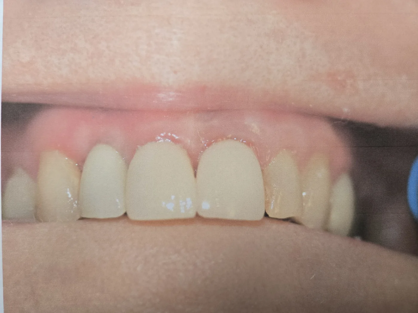 Dorothy after treatment photo