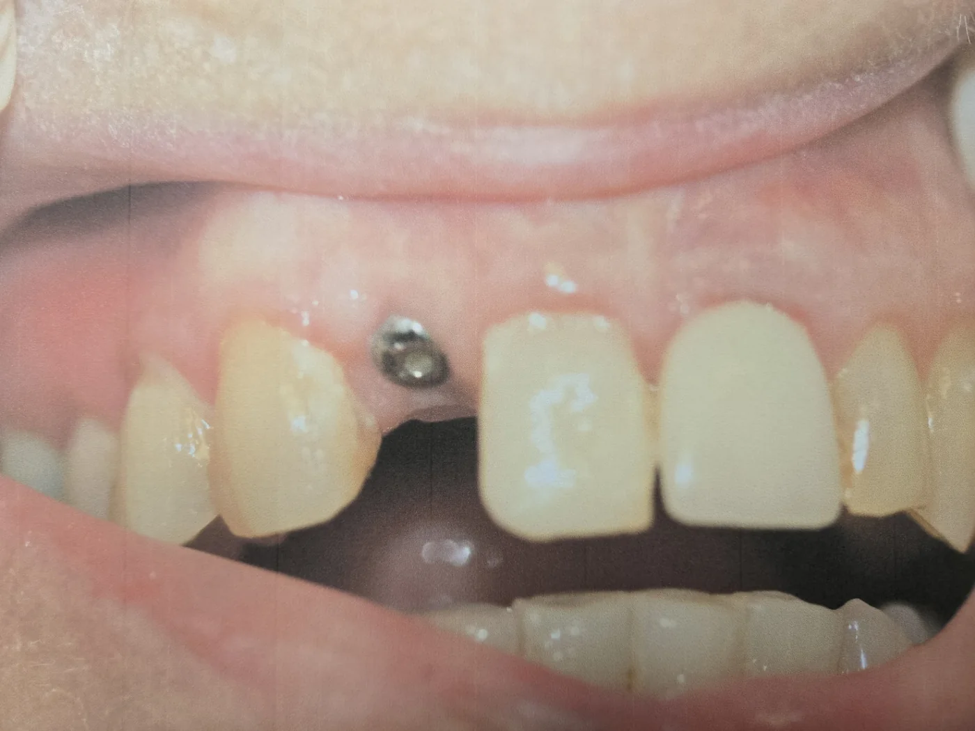 Dorothy before treatment photo